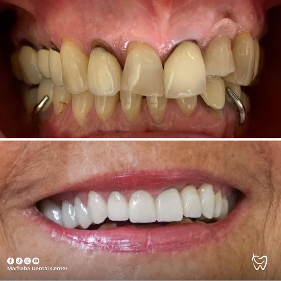 Cabinet dentaire Agadir